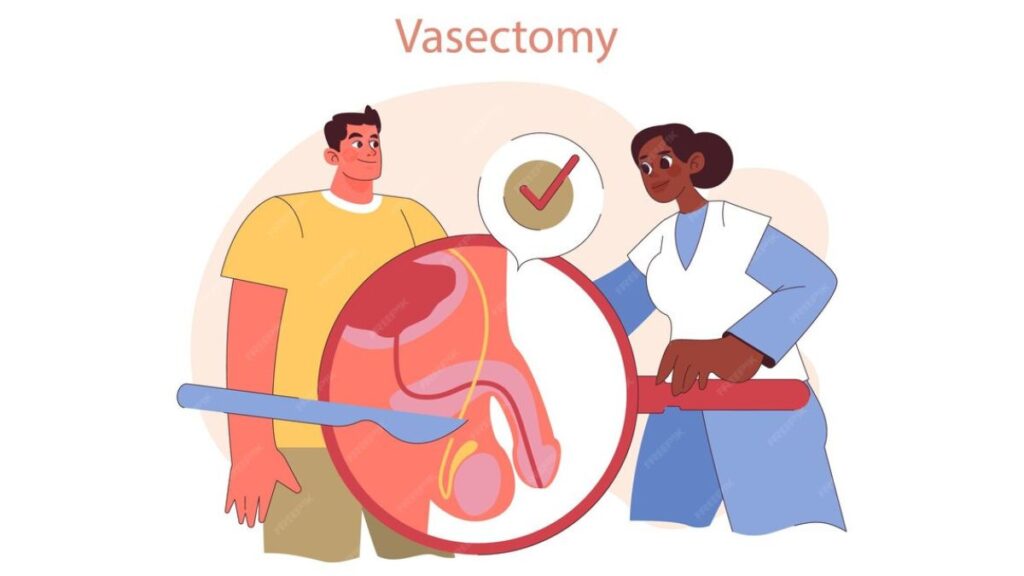Vasectomy